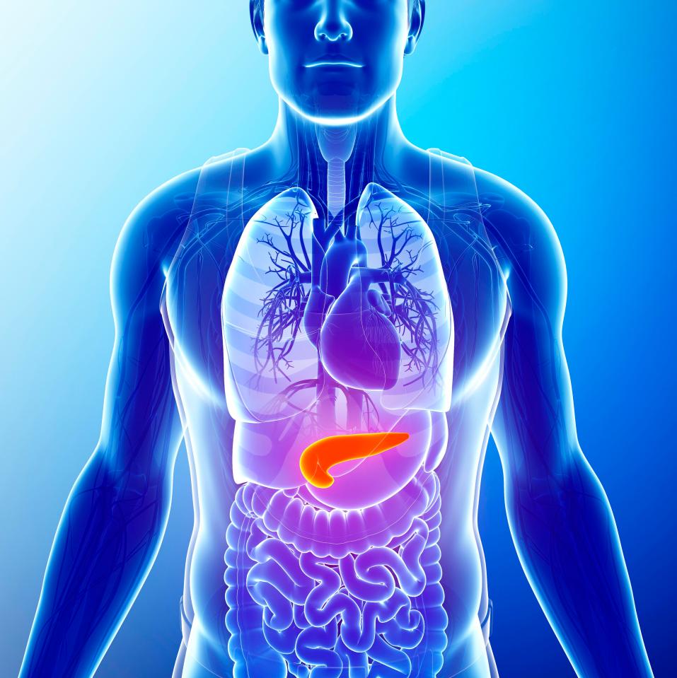  Pancreatitis occurs when your pancreas becomes swollen