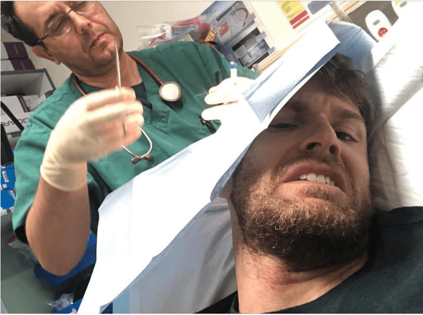 Dommett was rushed to hospital after being hit on the head with a wooden sign during rehearsals