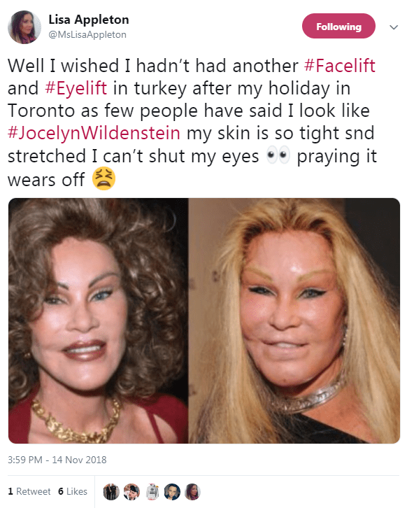  Lisa is worried she might look like Jocelyn Wildenstein