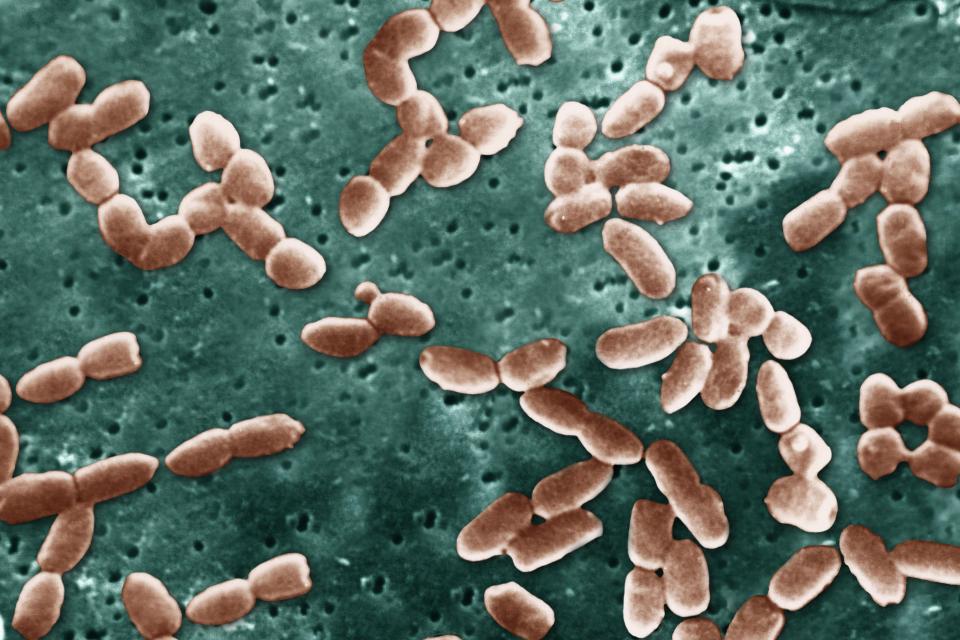  Deadly superbugs are going to kill 90,000 Brits over 30 years, experts have warned