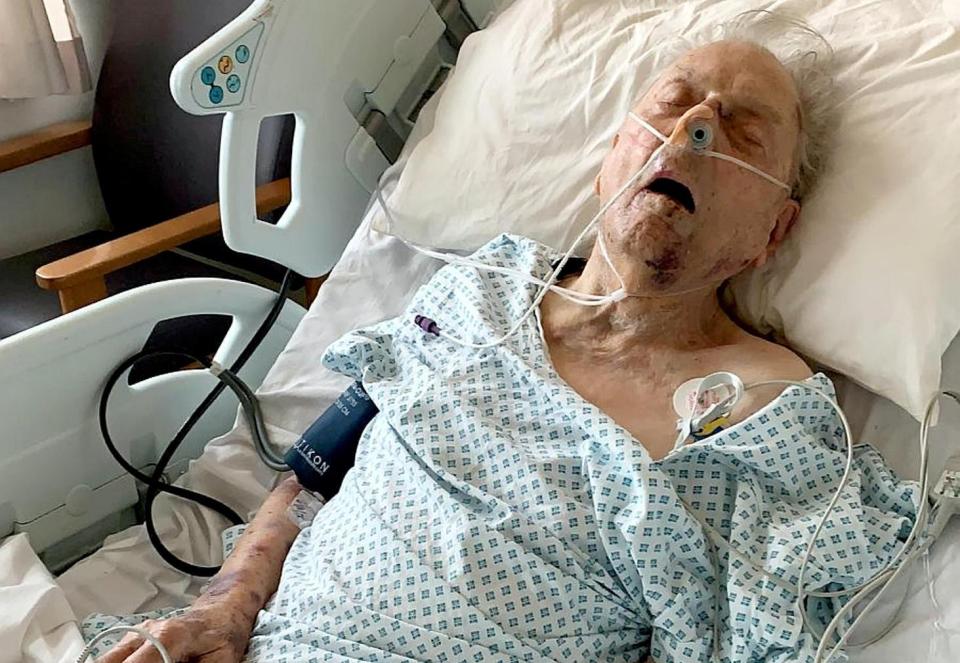  Peter Gouldstone, 98, was fighting for his life after a brutal attack in London