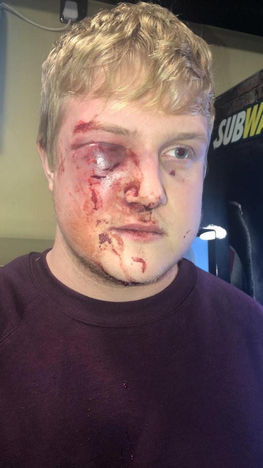  Ben Pearson, 21, was attacked outside Subway by two men