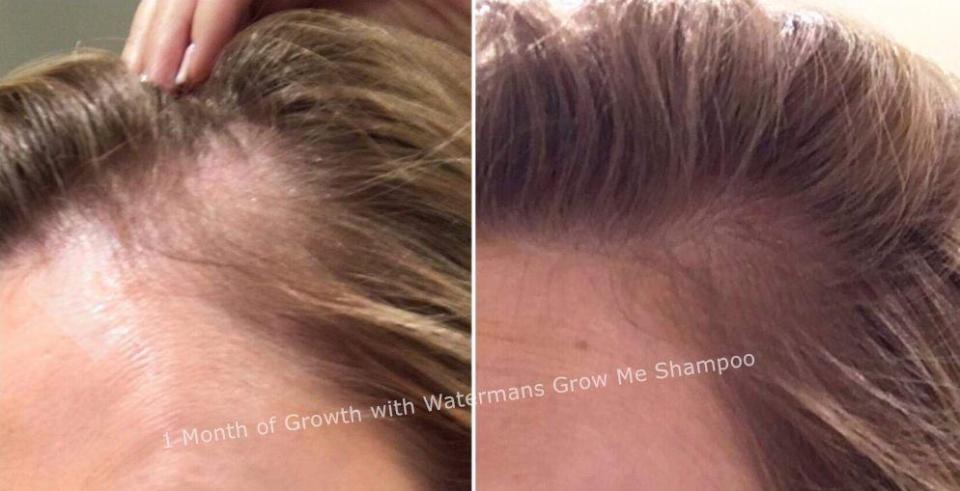  People have been sharing their hair transformations online