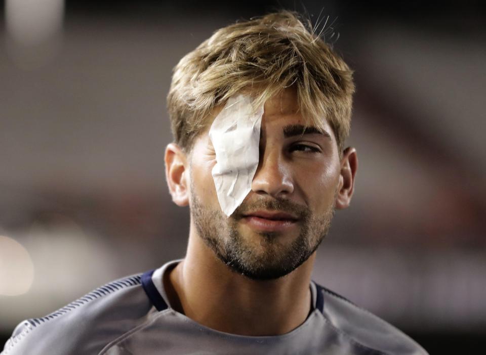 Lamaardo was spotted on the pitch with his eye is covered by a patch