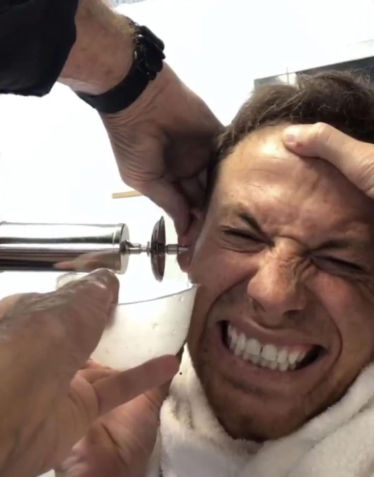  Joe Swash grimaced as his ear was syringed by a specialist after a cockroach got stuck in it