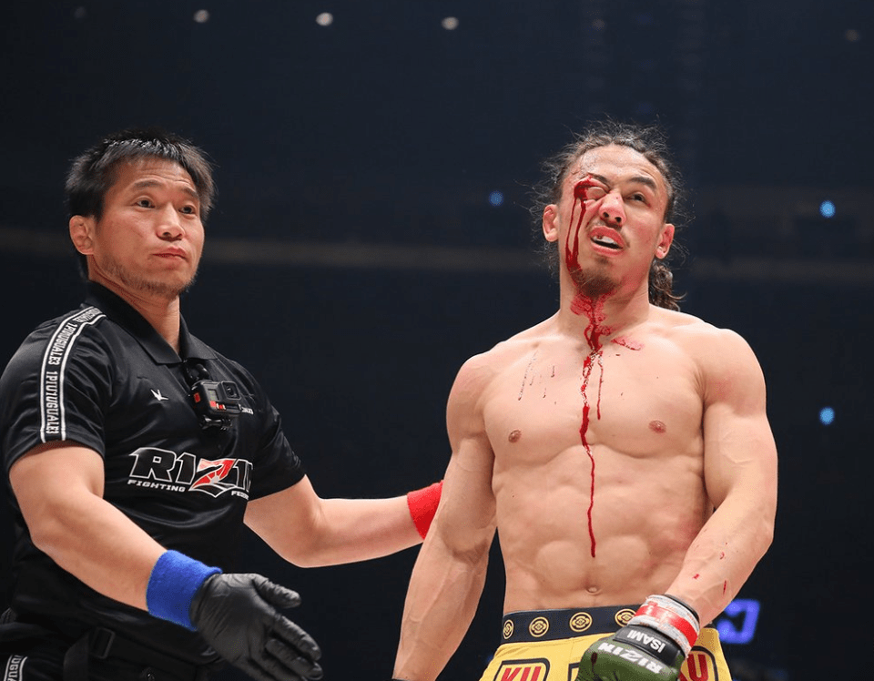 Yusuke Yachi suffered a disgusting eye injury in the build-up to Mayweather's fight