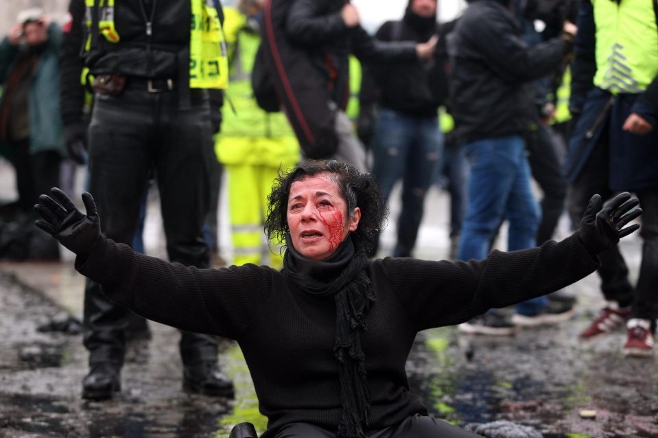  An injured woman pleads with police as she is caught up in the violence in Paris