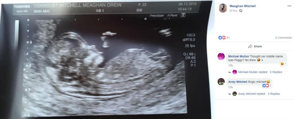  Meaghan Mitchell, the 'Fajita Cheater' uploaded this pregnancy scan to Facebook on Tuesday