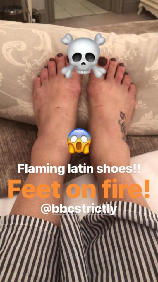  Faye Tozer shows impact of training on her feet on social media