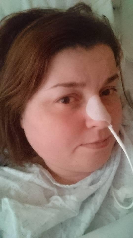  Clare had to wear a feeding tube for nine months during her treatment