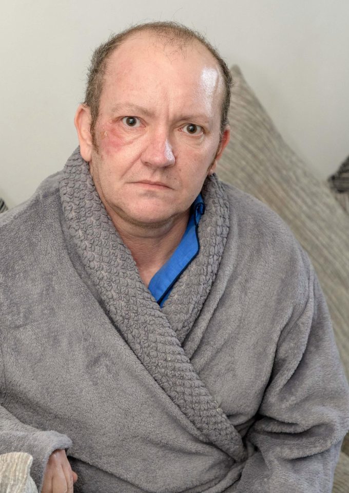  Dean Lovell-Payne, 52, attempted suicide after being kept waiting for Universal Credit for 10 weeks