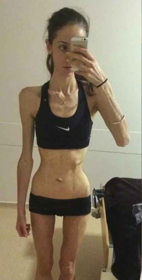  She used to exercise for eight hours a day and would eat only 300 calories a day