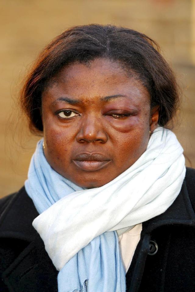  Cheryl was convicted of assaulting Sophie Amoj Amogbokpa, pictured, a toilet attendant at The Drink in Guildford