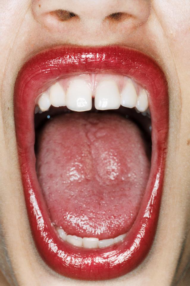  A white-coated tongue can be a sign of a fungus infection while a red tongue can show a vitamin B12 deficiency