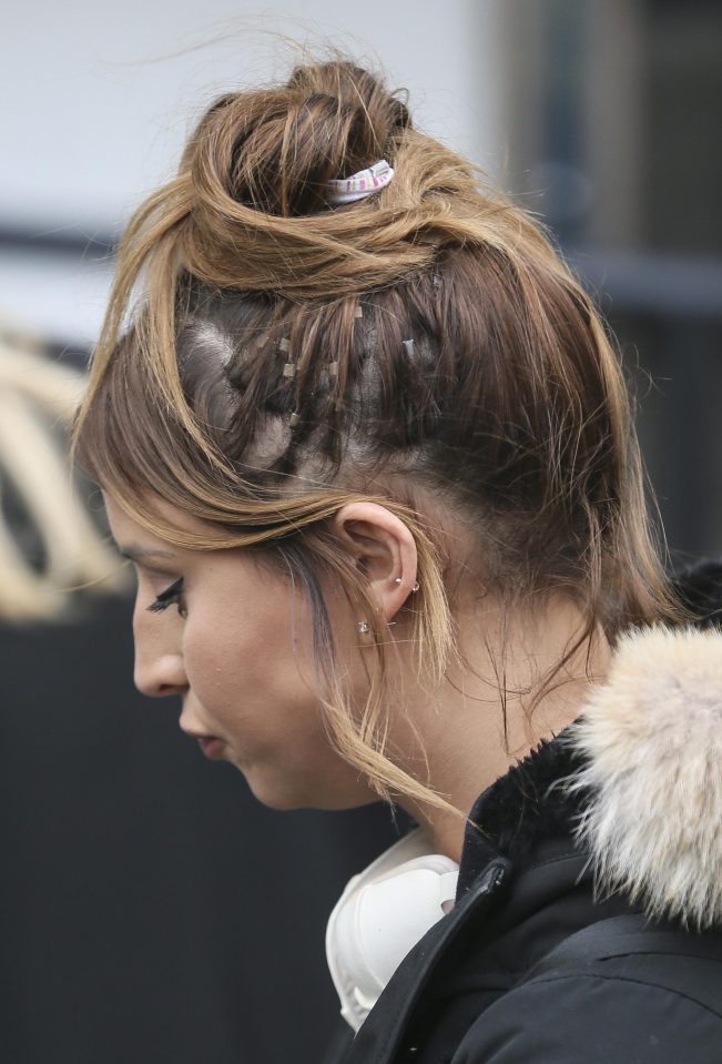  Ferne McCann reveals her patchy skin with tape extensions visible