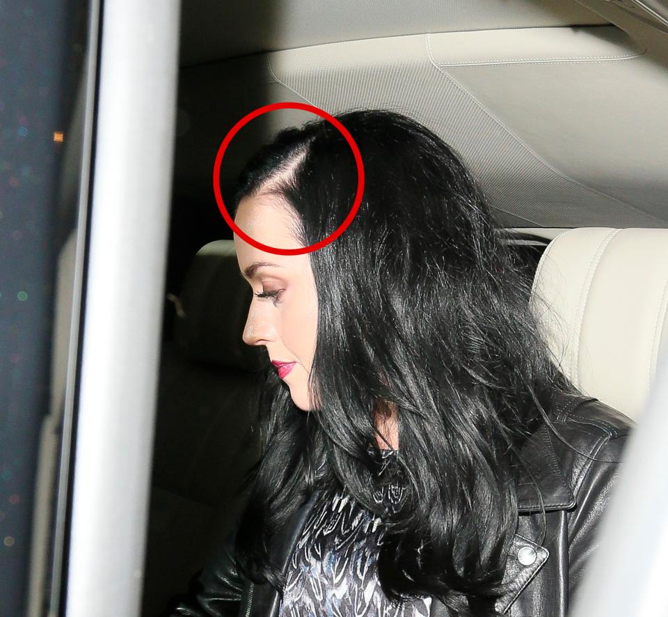  Katy Perry was pictured leaving a London restaurant in 2013 with a patchy scalp