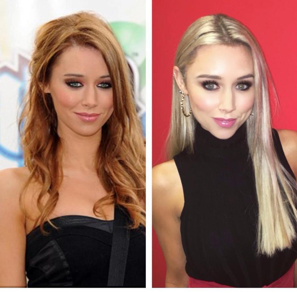 Una Healy