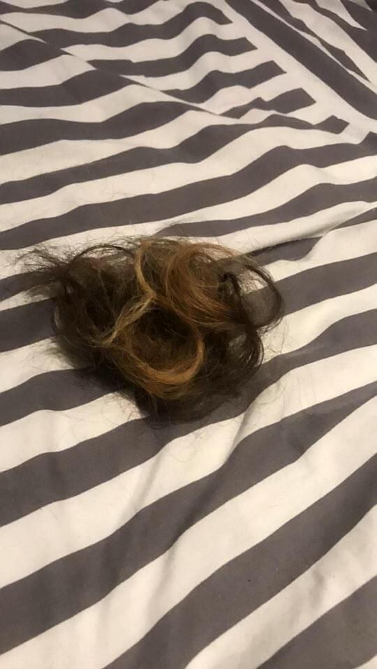  The teenager says she was left with a pile of hair and a sore scalp