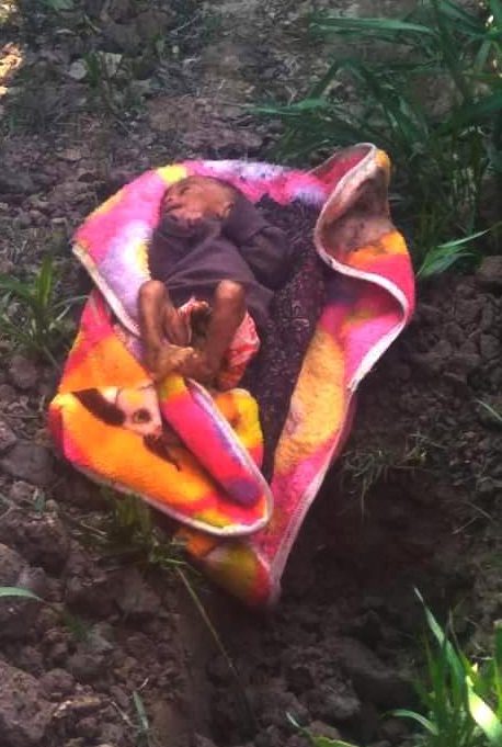 This baby was buried alive for at least three hours in a blanket next to a pond in India, in 2019