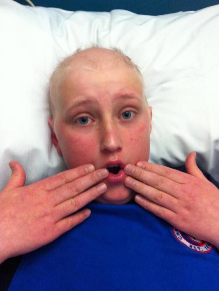  Andrew was just 13 when he was diagnosed with cancer