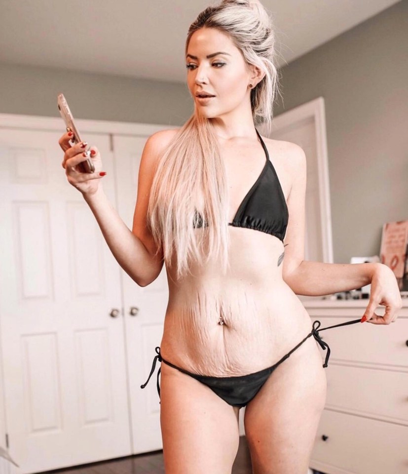 A mum-of-three has shown off her cellulite, stretch marks and scars online