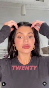  Kylie Jenner has talked about her lip fillers