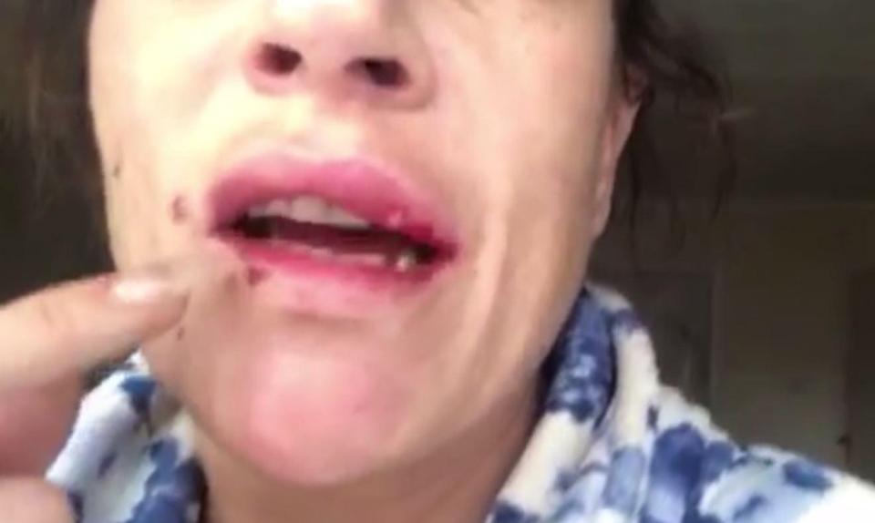  The area around her mouth looks incredibly red and sore