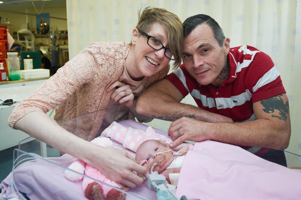  Vanellope Wilkins need emergency surgery within an hour of birth to put her heart into her chest