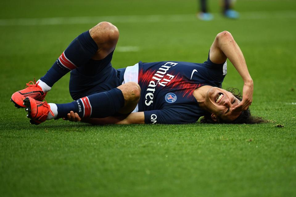  Edinson Cavani was taken off injured at half-time with a thigh injury