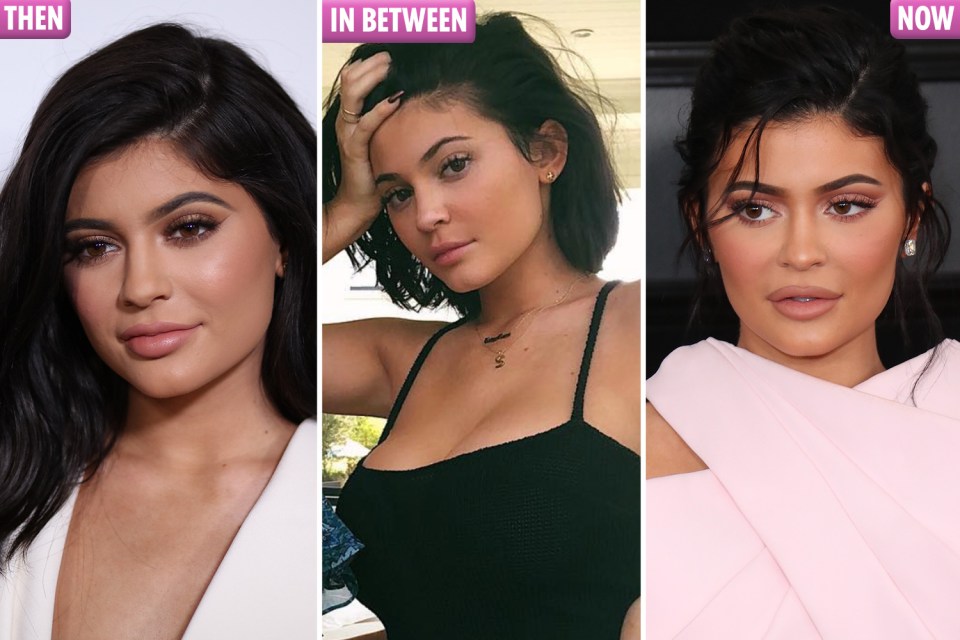 Talking about her lip fillers, Kylie Jenner says: 'I went too far. It was very painful'