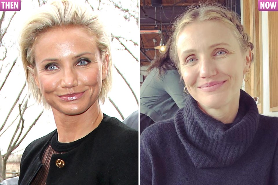 Cameron Diaz has banished her Botox look on the left admitted she’s happy with her laughter lines