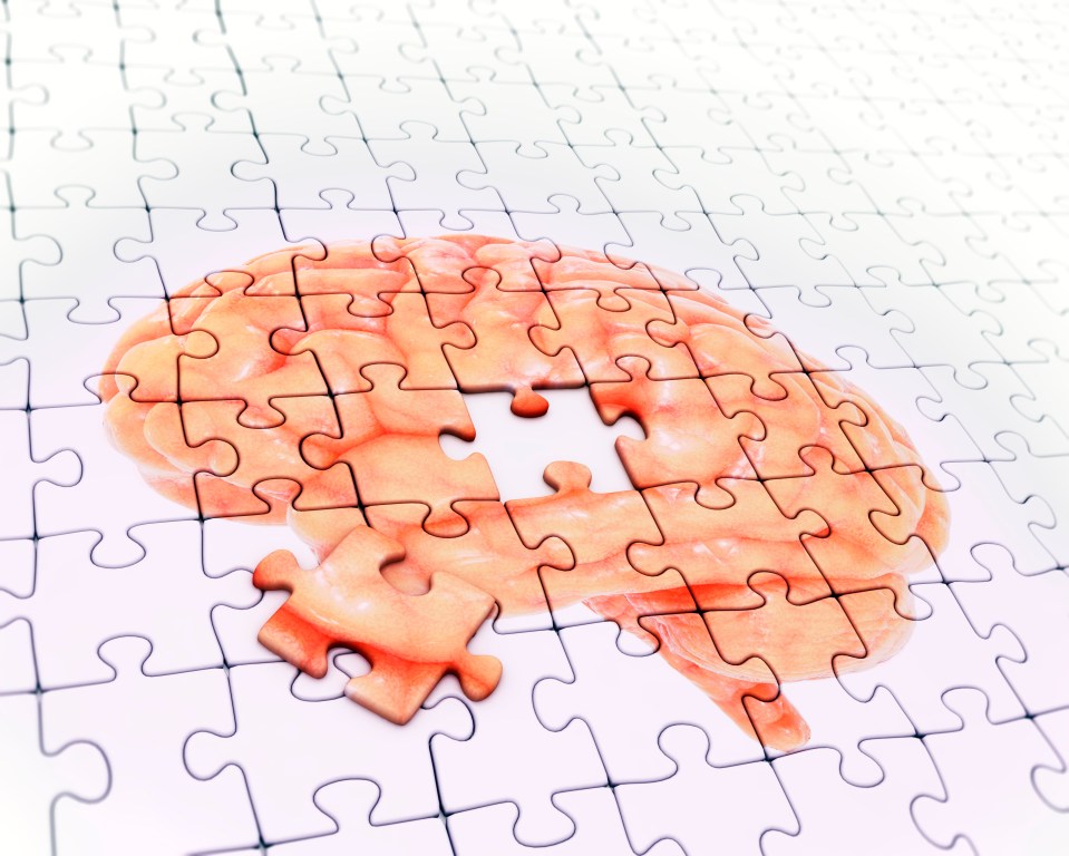  The MIND diet has been found to help with the prevention of Alzheimer's