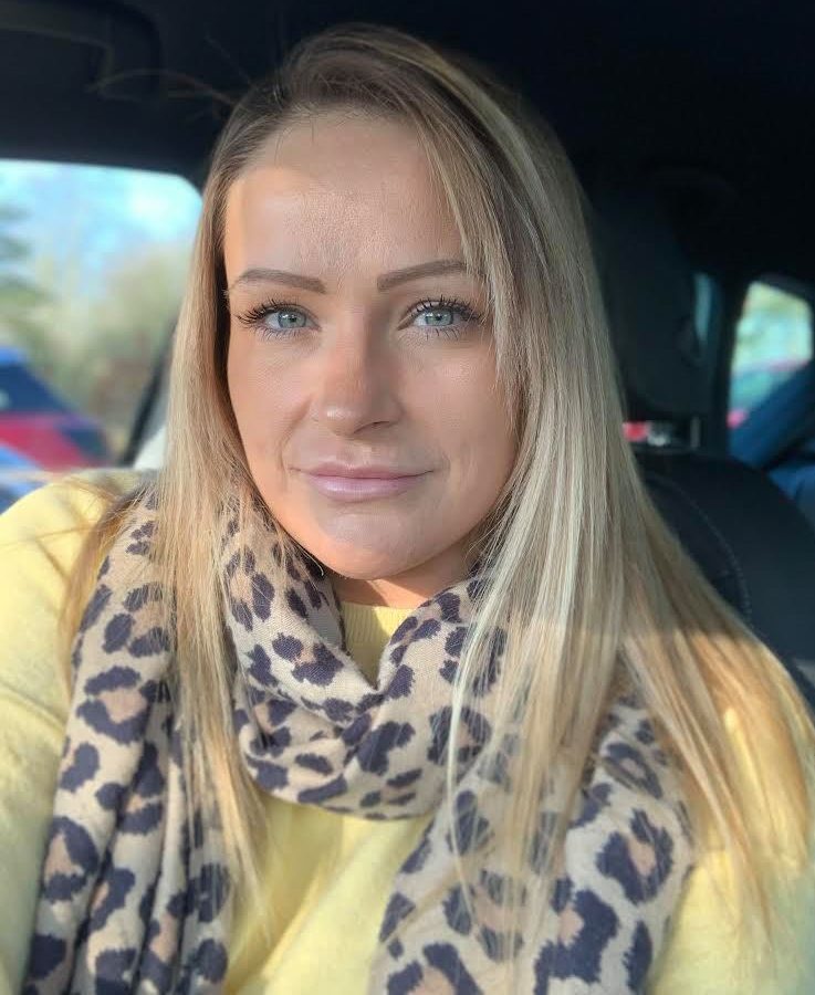 Nickie Murtagh, 34, from New Malden, Surrey, was diagnosed with skin cancer and has been left with a 'hole' in her head after having it removed