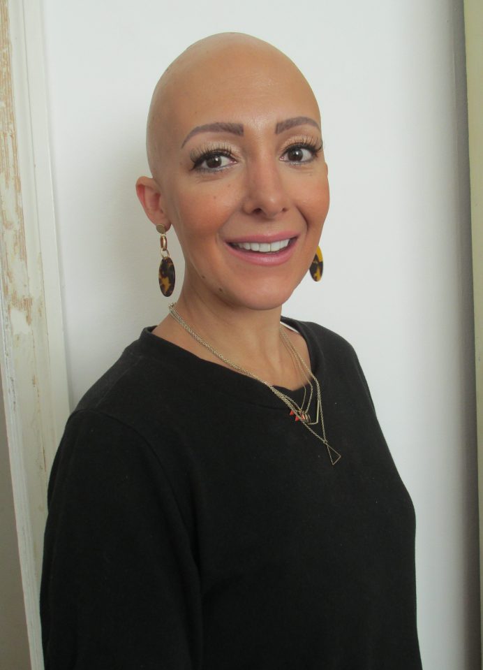  Rima Theisen lost every single hair on her body in August 2018