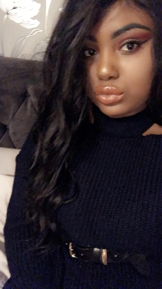 Monae Paris-Davis further lip fillers