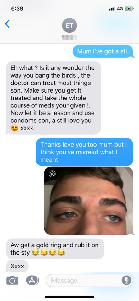  Brogan Tant tried to tell his mum about an eye infection - with hilarious results