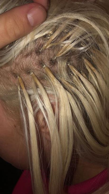  Mairead claims that Lux Extensions have ignored her request to remove her 'painful' hair