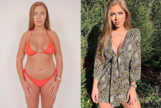  The former Love Island contestant's weight loss is partly thanks to Forza Supplements