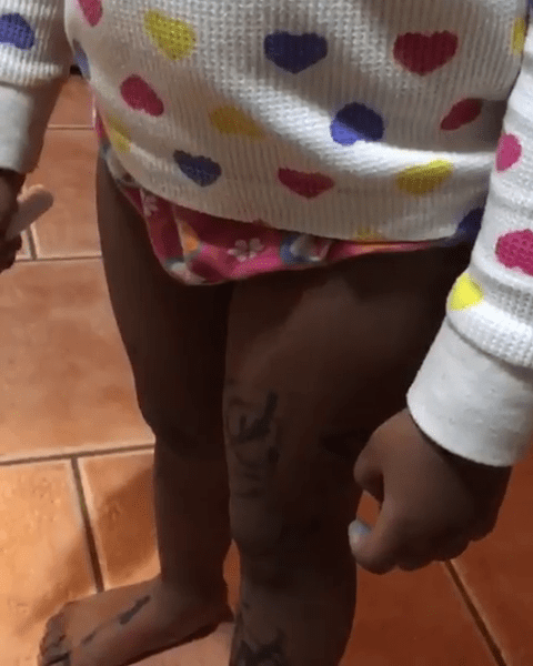  The pigtailed toddler was discovered by the older lady with dark blue pen all over her forehead, lips, nose, cheeks and legs