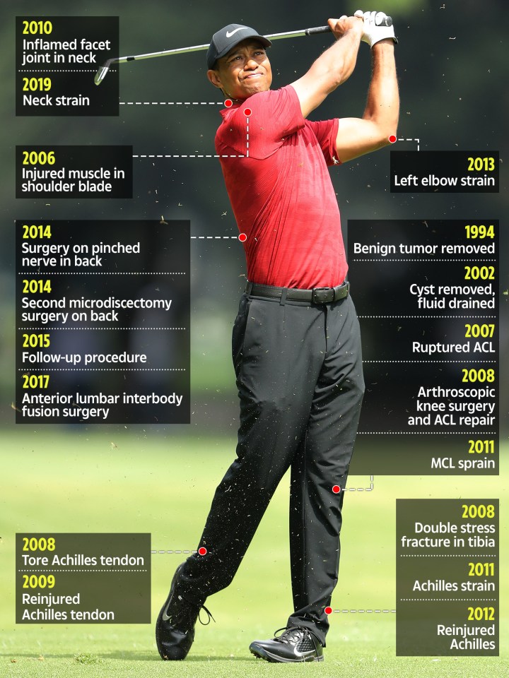  Tiger Woods' injury timeline shows a battered body that has had to be put back together again