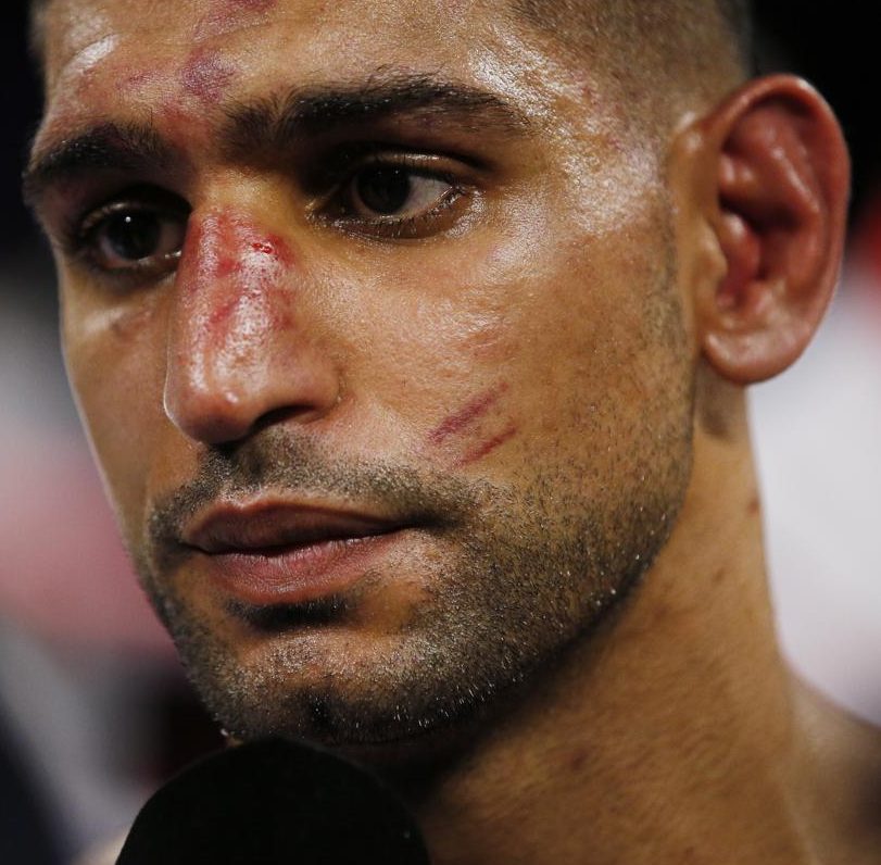 Amir Khan must now show his daughter his battered face and explain it to her