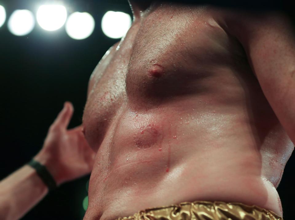 David Price was left with bite marks on his body in shocking scenes