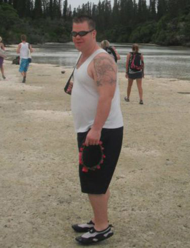  Dean Koenig weighed 341lbs at his heaviest after he was hit by a car in 2010