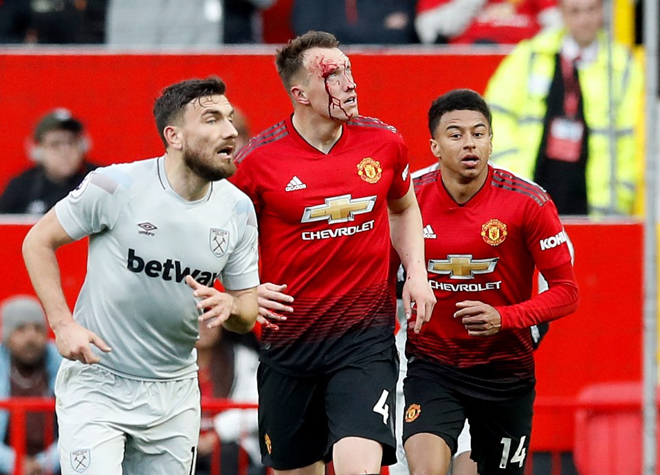  Jones suffered a gruesome head injury after a collision with West Ham's Declan Rice