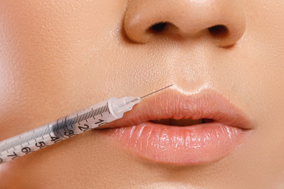  You will soon be able to get lip fillers in even more Superdrug shops