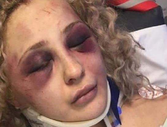  Britney's cousin described her as being beaten 'black and blue' by the attacker