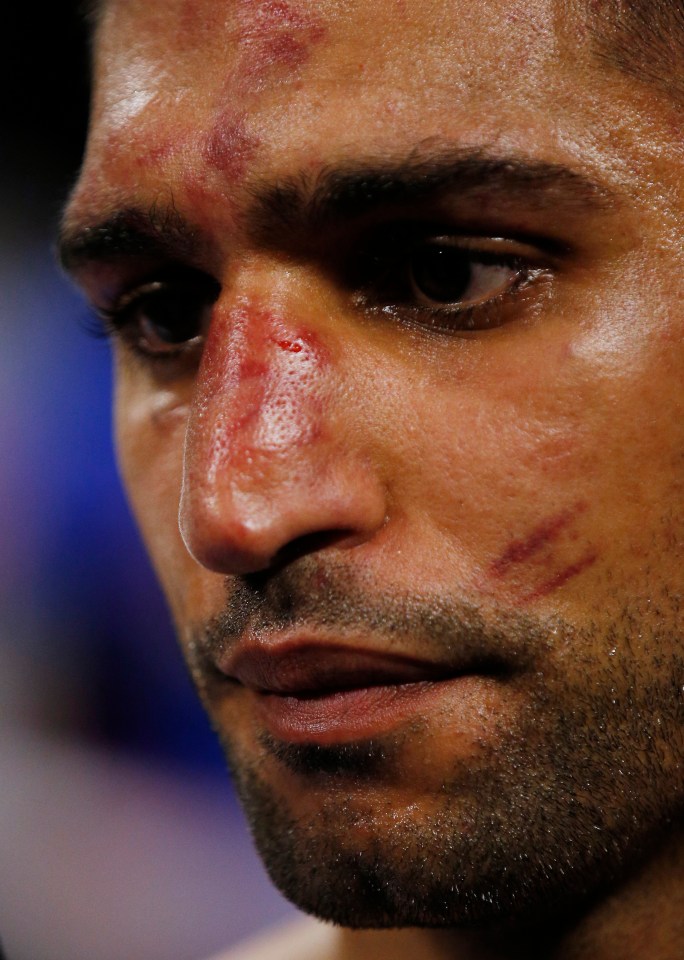 Khan was battered and bruised after his encounter with Crawford