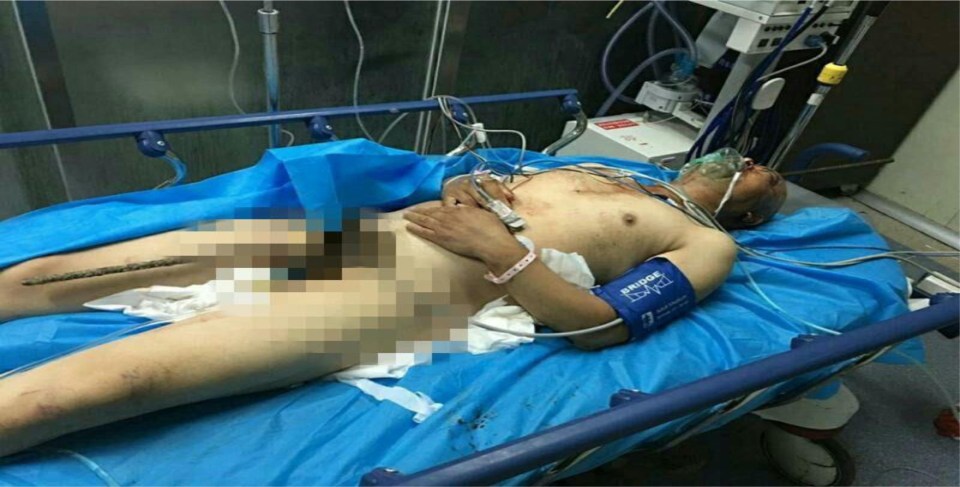 This shocking image shows the man lying in hospital before the bar was successfully removed