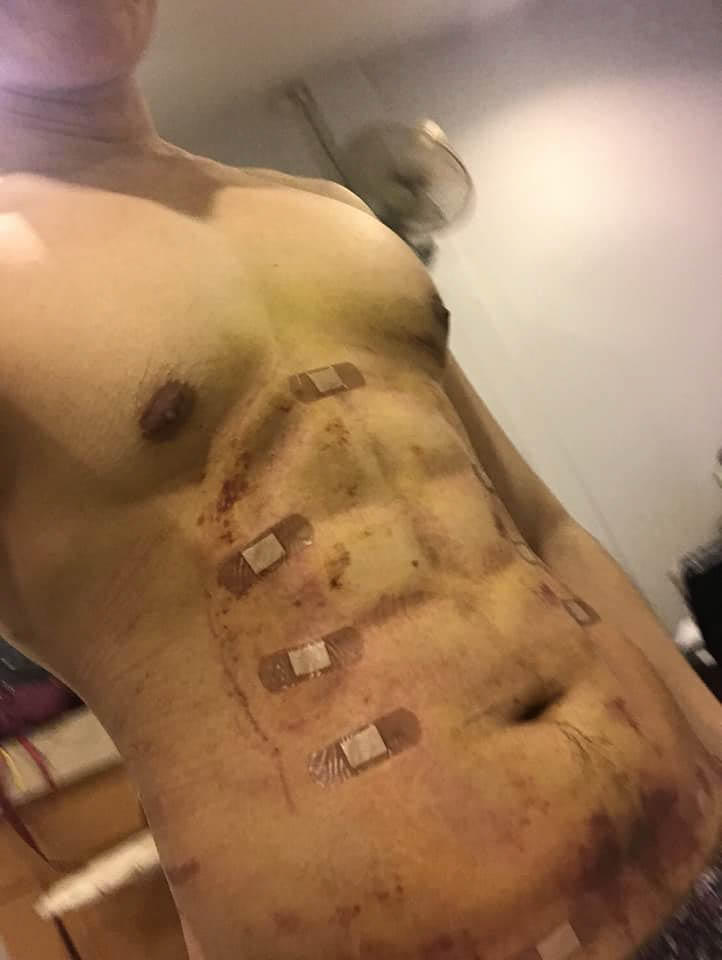  Grisly pictures show his body before, during and after the surgery