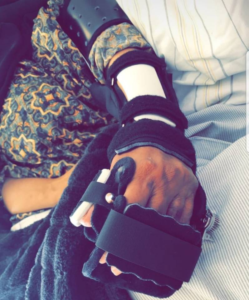  This picture shows her hand after tendon surgery which has enabled her to use her arm again. She remains paralysed from the waist down